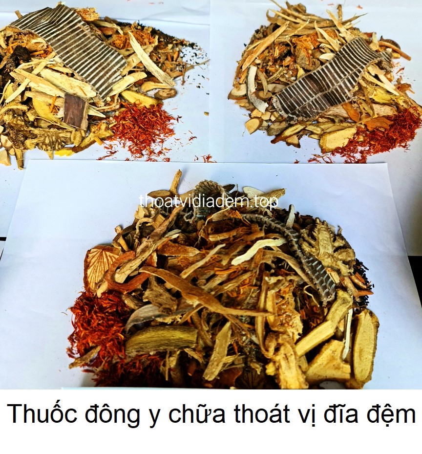 Thuốc đông y chữa thoát vị đĩa đệm